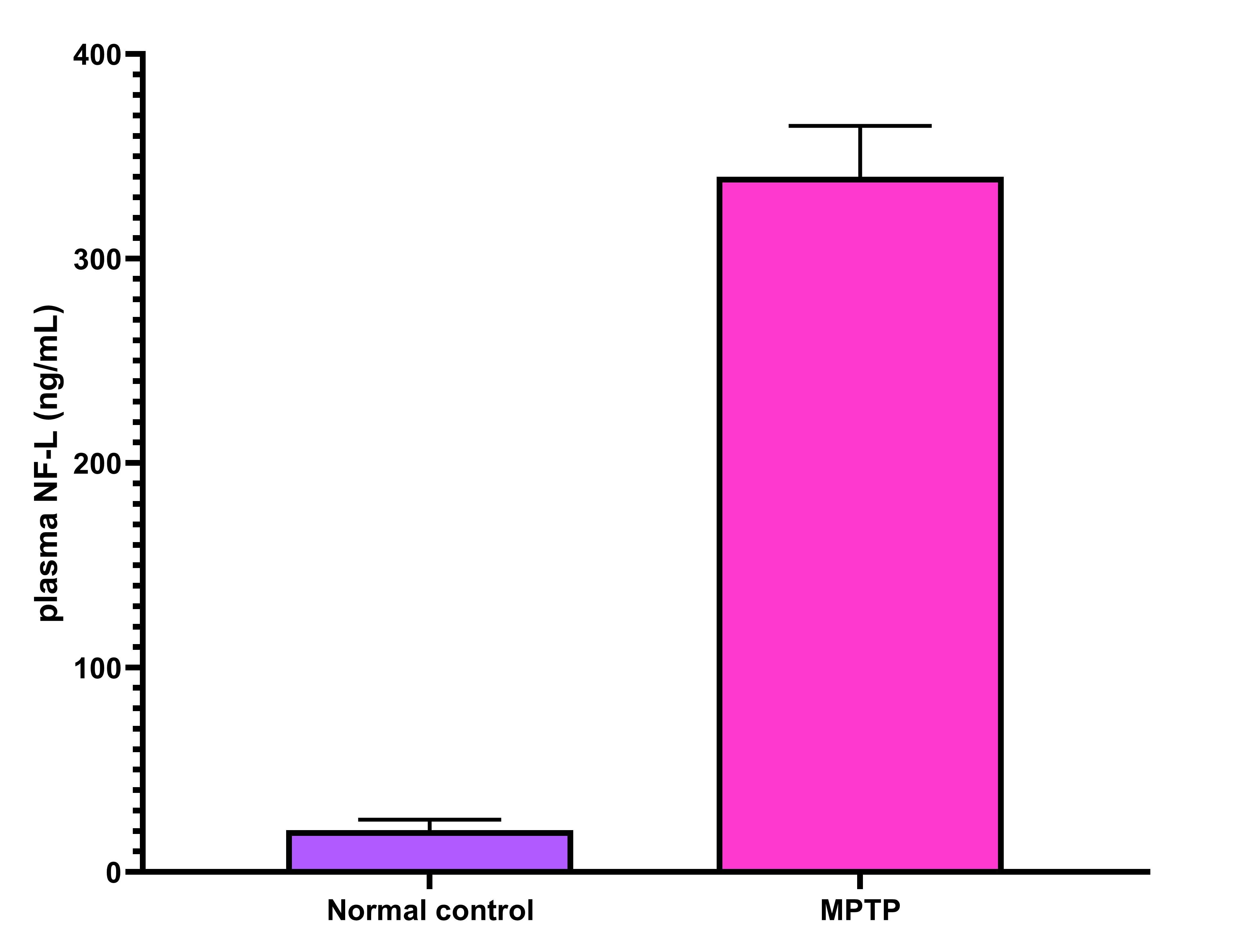 Rat NF-L ELISA Kit (Colorimetric) NBP2-81185