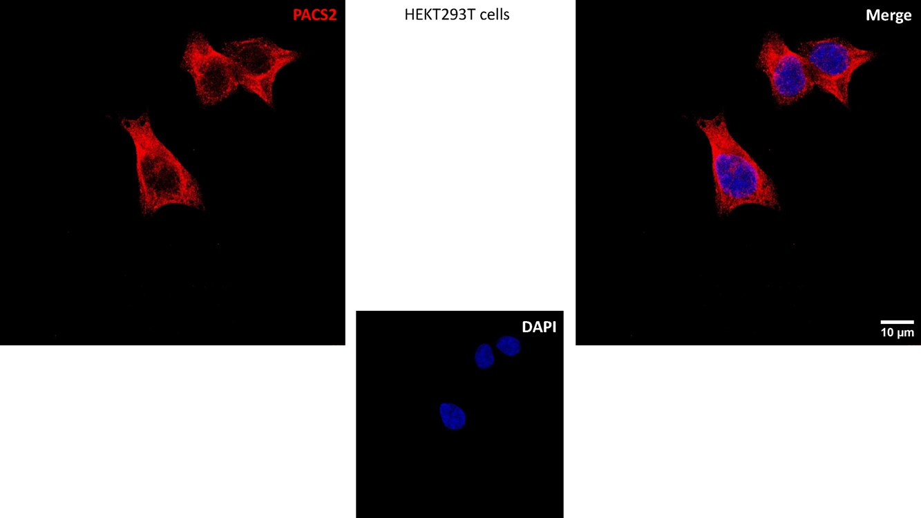 PACS2 Antibody [Alexa Fluor® 488] NBP2-81975AF488