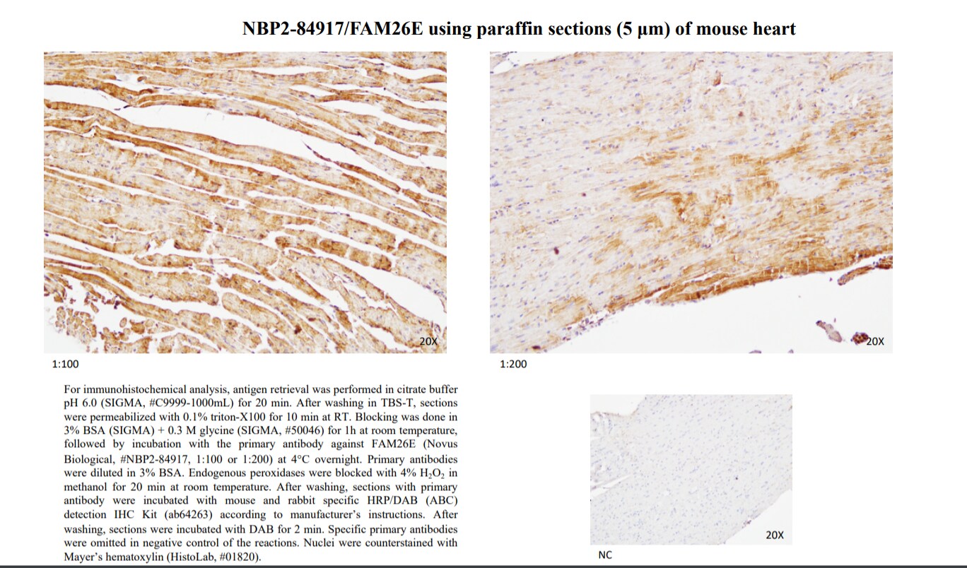 FAM26E Antibody - BSA Free NBP2-84917