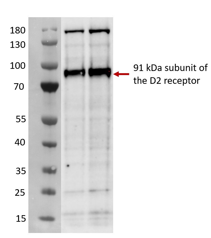 Dopamine D2R/DRD2 Antibody - BSA Free NBP2-88996