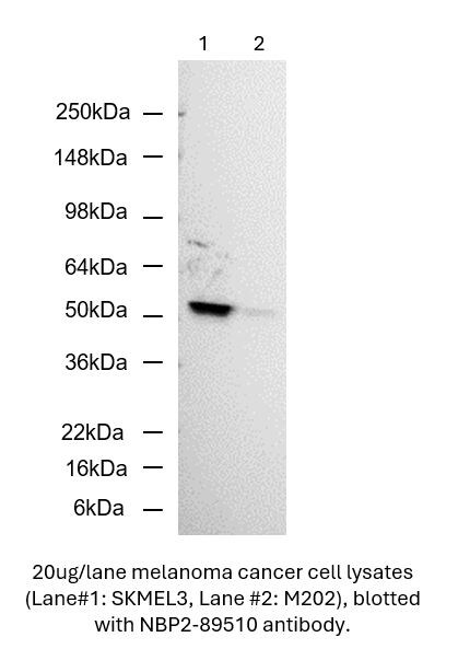 Carbonic Anhydrase XIV/CA14 Antibody (515) - Azide and BSA Free NBP2-89510