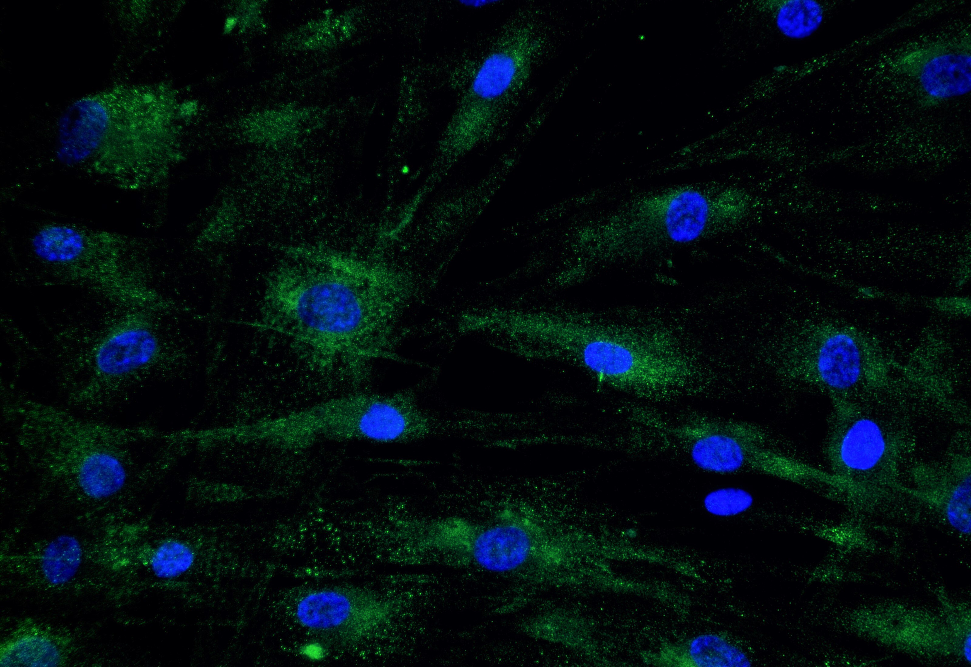 COMP/Thrombospondin-5 Antibody - BSA Free NBP2-92733