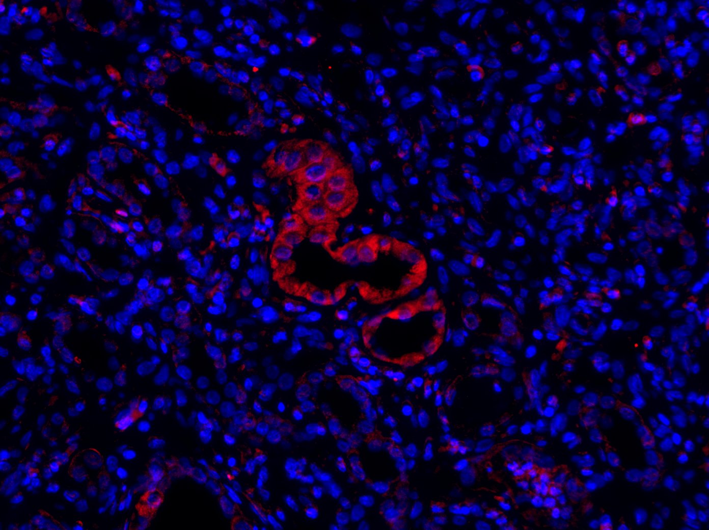 Aquaporin-3 Antibody - BSA Free NBP2-92885