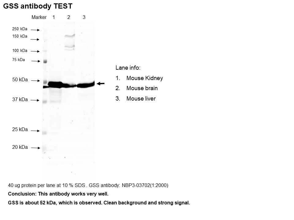 Glutathione Synthetase Antibody - Azide and BSA Free NBP3-03702