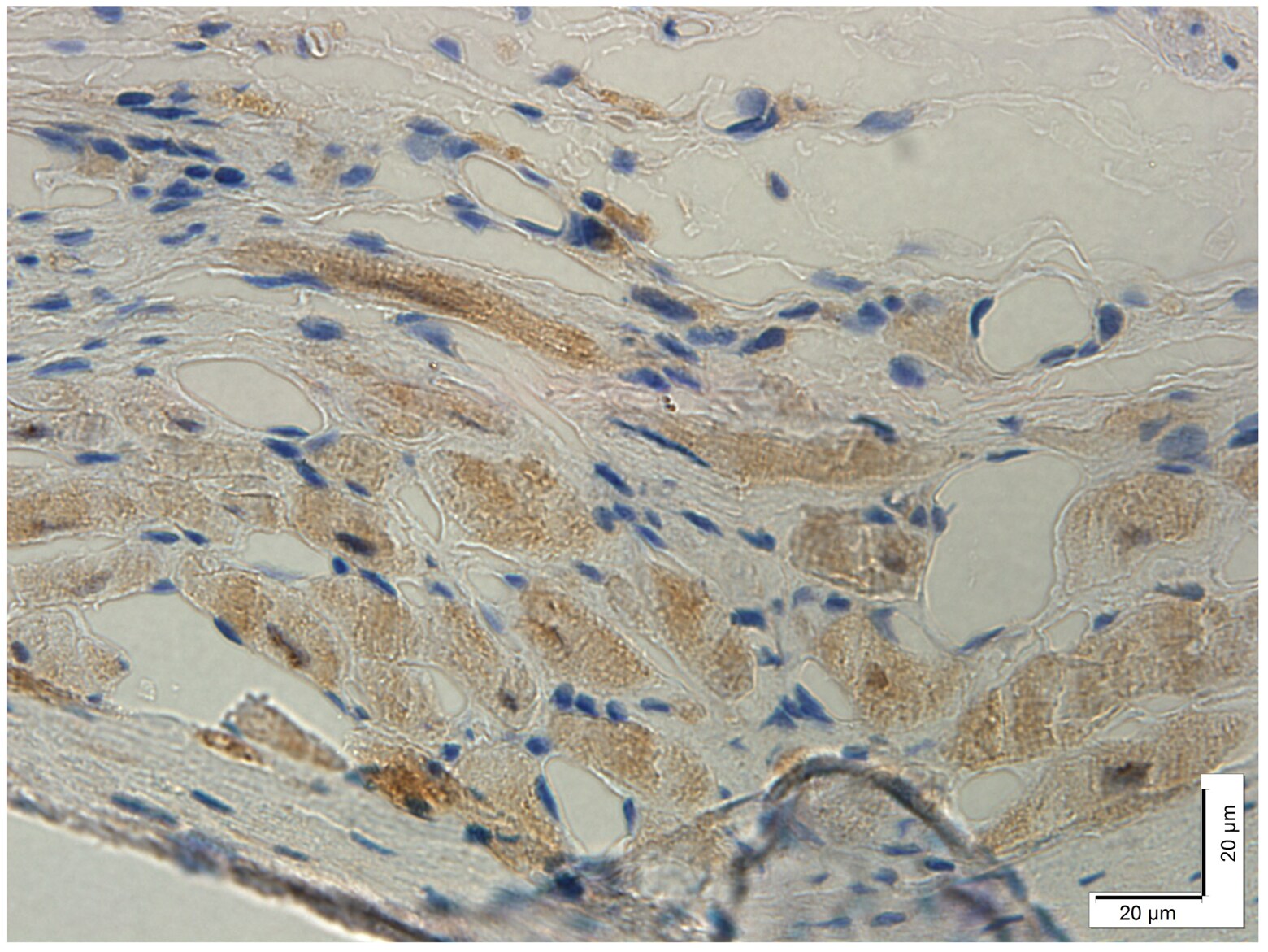 Kv4.2 Antibody - BSA Free NBP3-03748