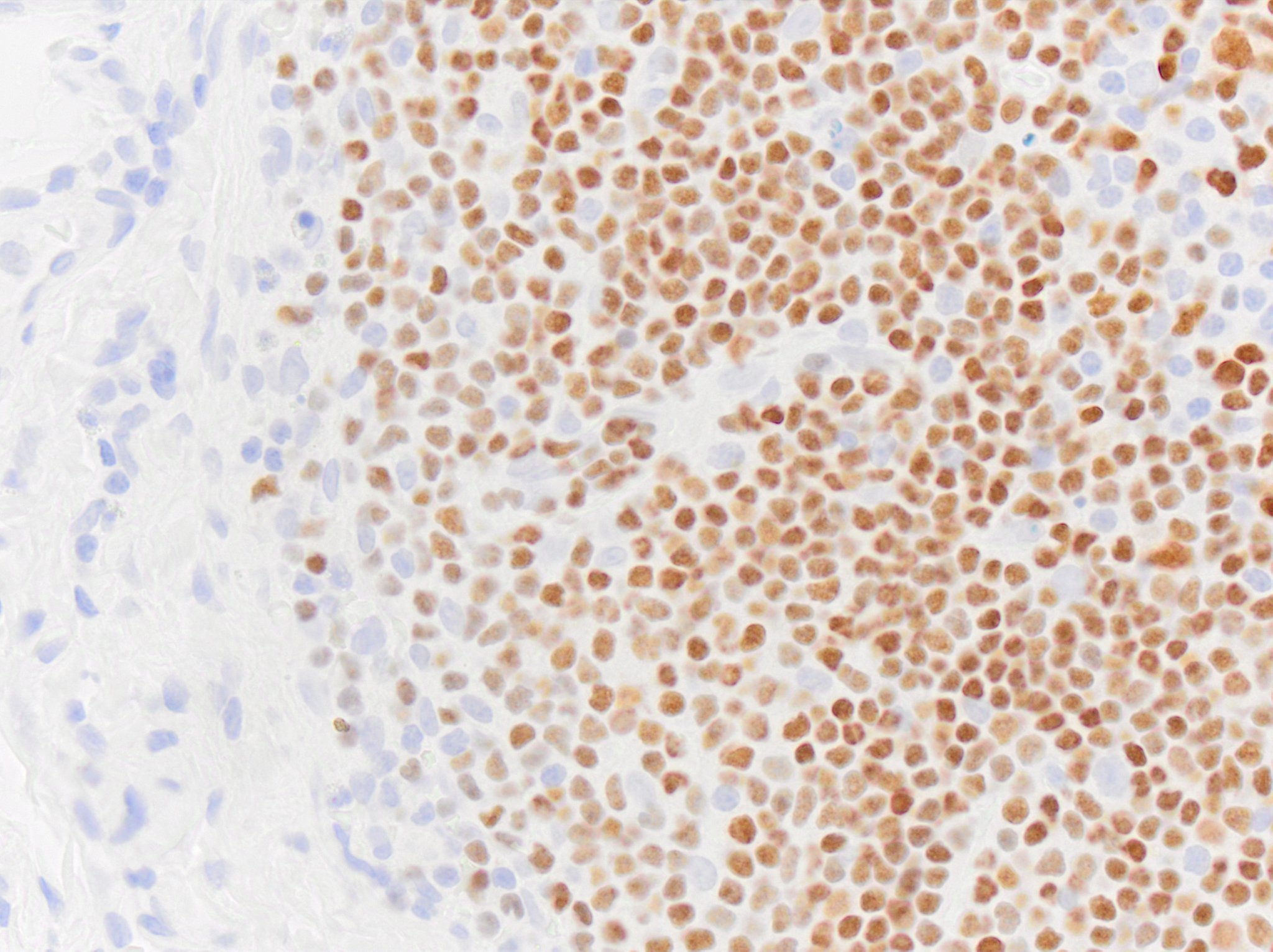 Pax5/BSAP Antibody (PAX5/3735) NBP3-07581