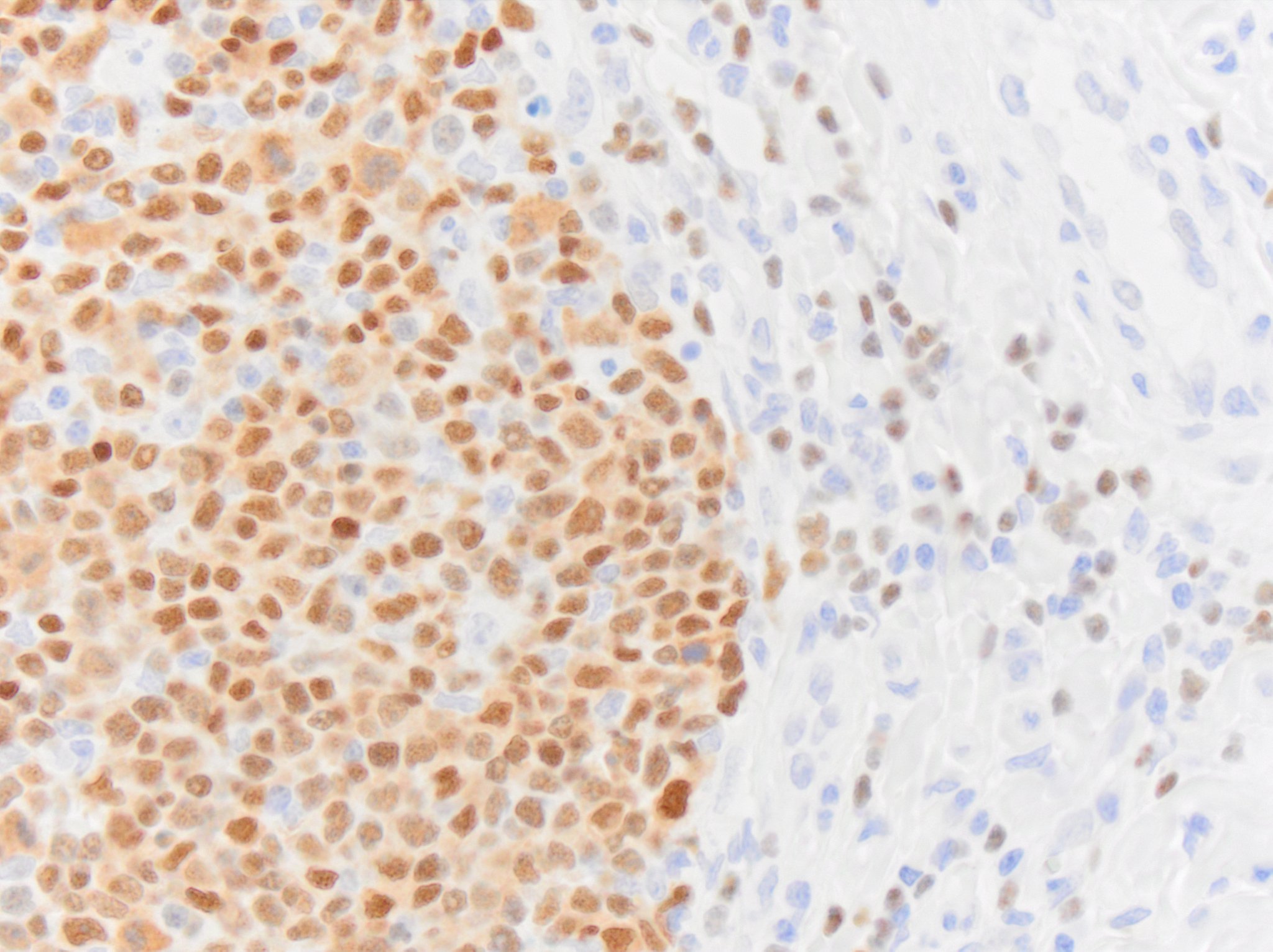 Pax5/BSAP Antibody (PAX5/3735) NBP3-07581