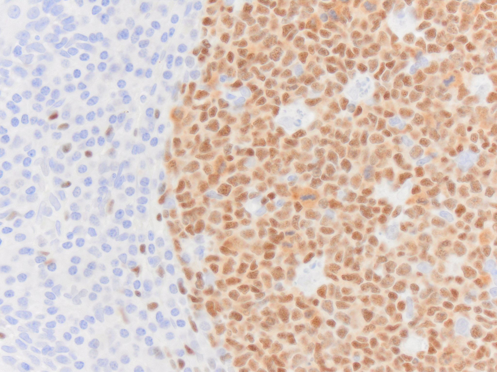 Pax5/BSAP Antibody (PAX5/3735) NBP3-07581