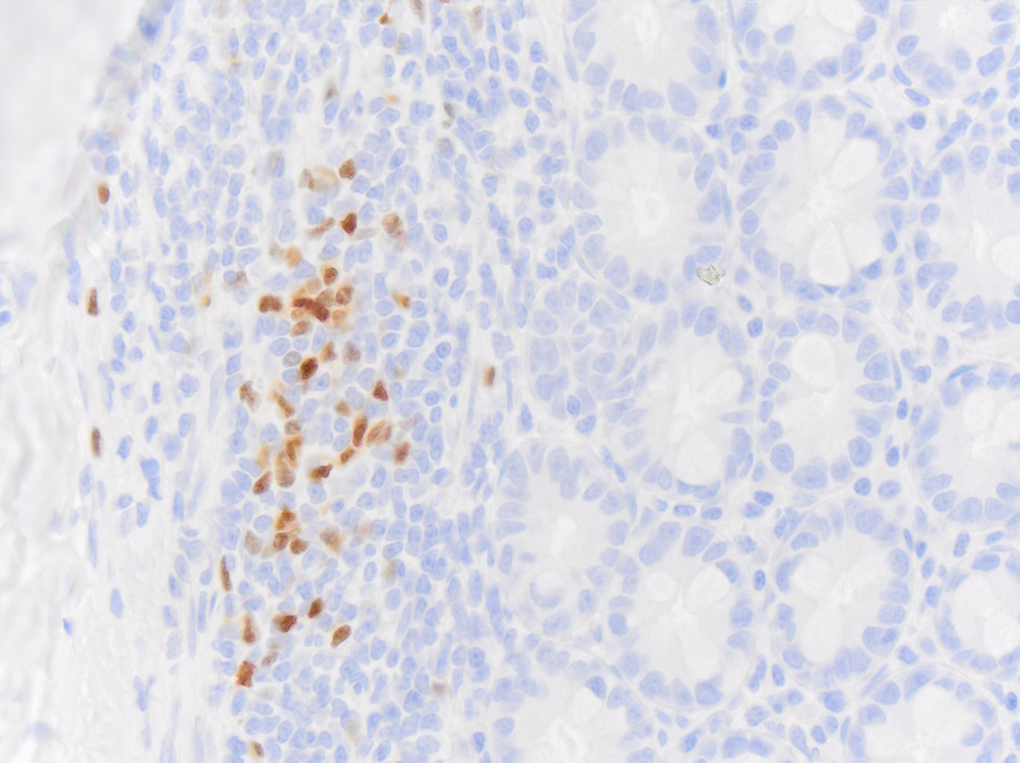 Pax5/BSAP Antibody (PAX5/3735) NBP3-07581