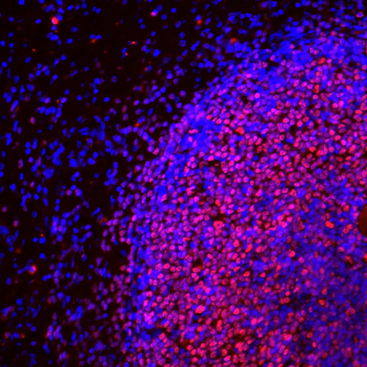 Pax5/BSAP Antibody (PAX5/3735) NBP3-07581