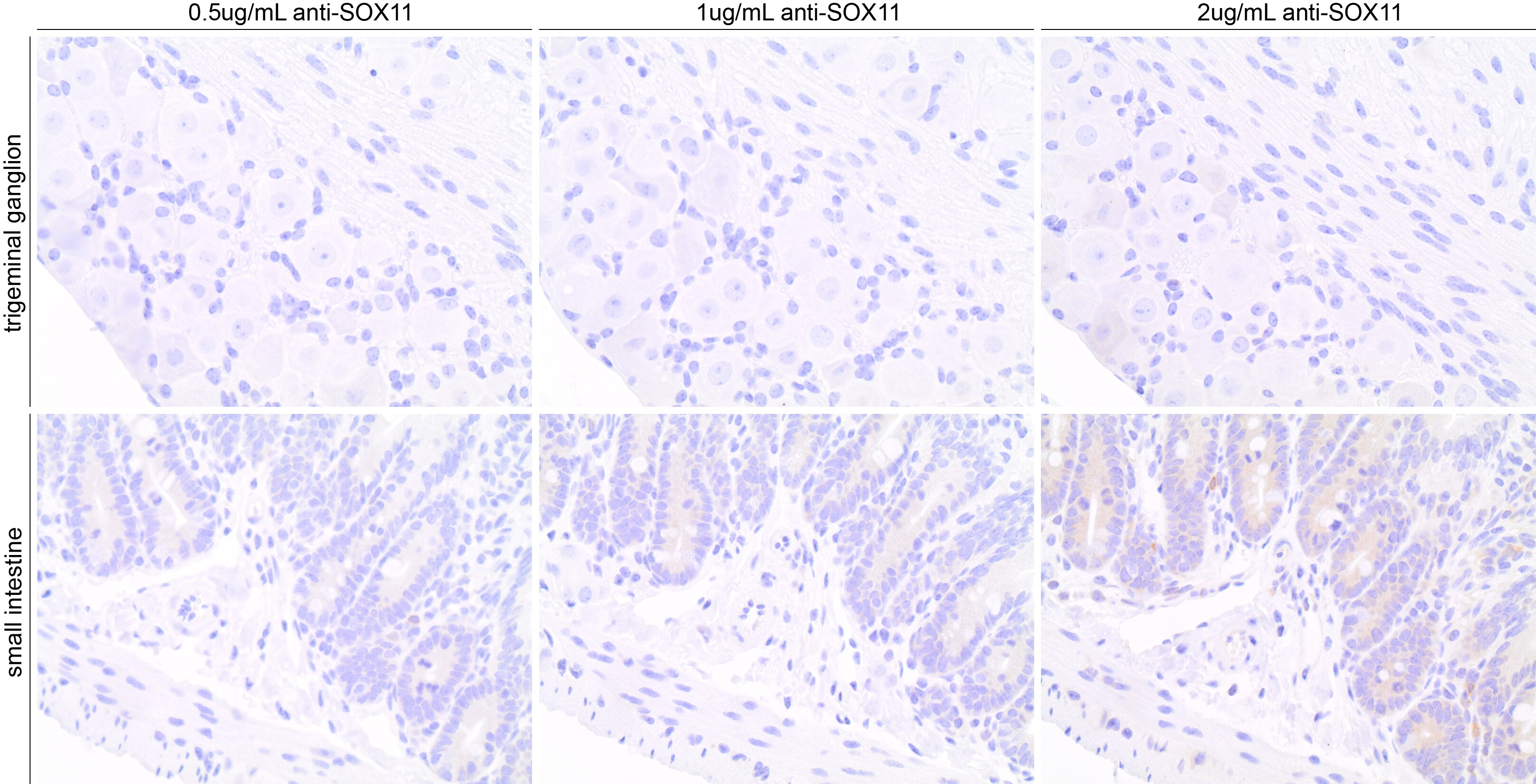 SOX11 Antibody (SOX11/3235R) NBP3-07688