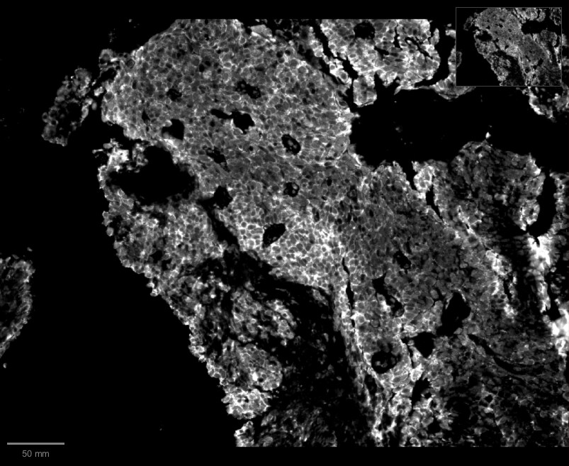 p16INK4a/CDKN2A Antibody (CDKN2A/4499) - Azide and BSA Free NBP3-08438