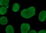 Common beta Chain Antibody (BION-1) - Chimeric - Azide and BSA Free NBP3-09025