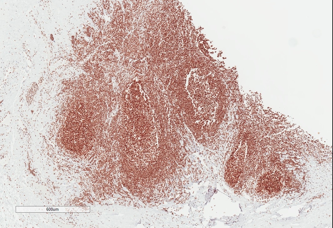 Nucleolin Antibody (NCL/7014R) NBP3-11037