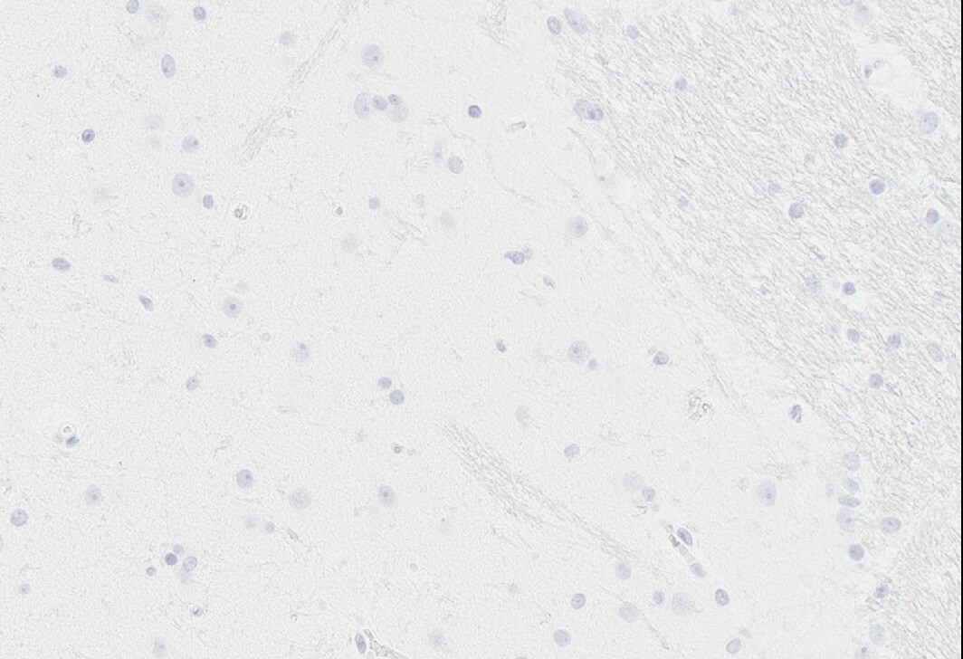 Nucleolin Antibody (NCL/7014R) NBP3-11037