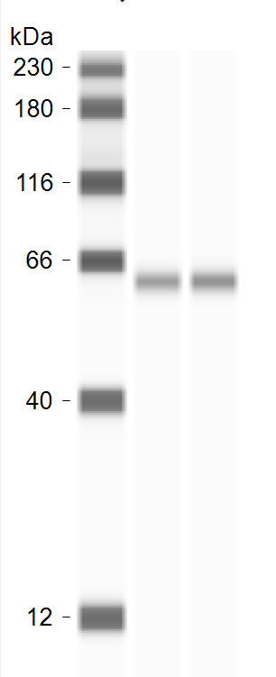 Monoamine Oxidase B Antibody (5M8A5) NBP3-15411