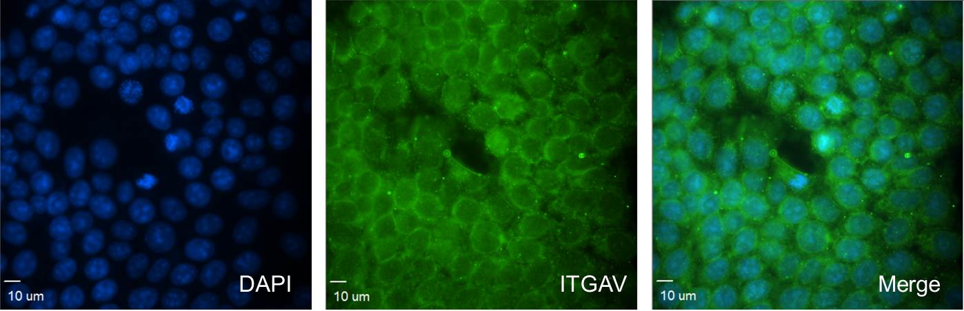 Integrin alpha V/CD51 Antibody (10T9N2) NBP3-15647