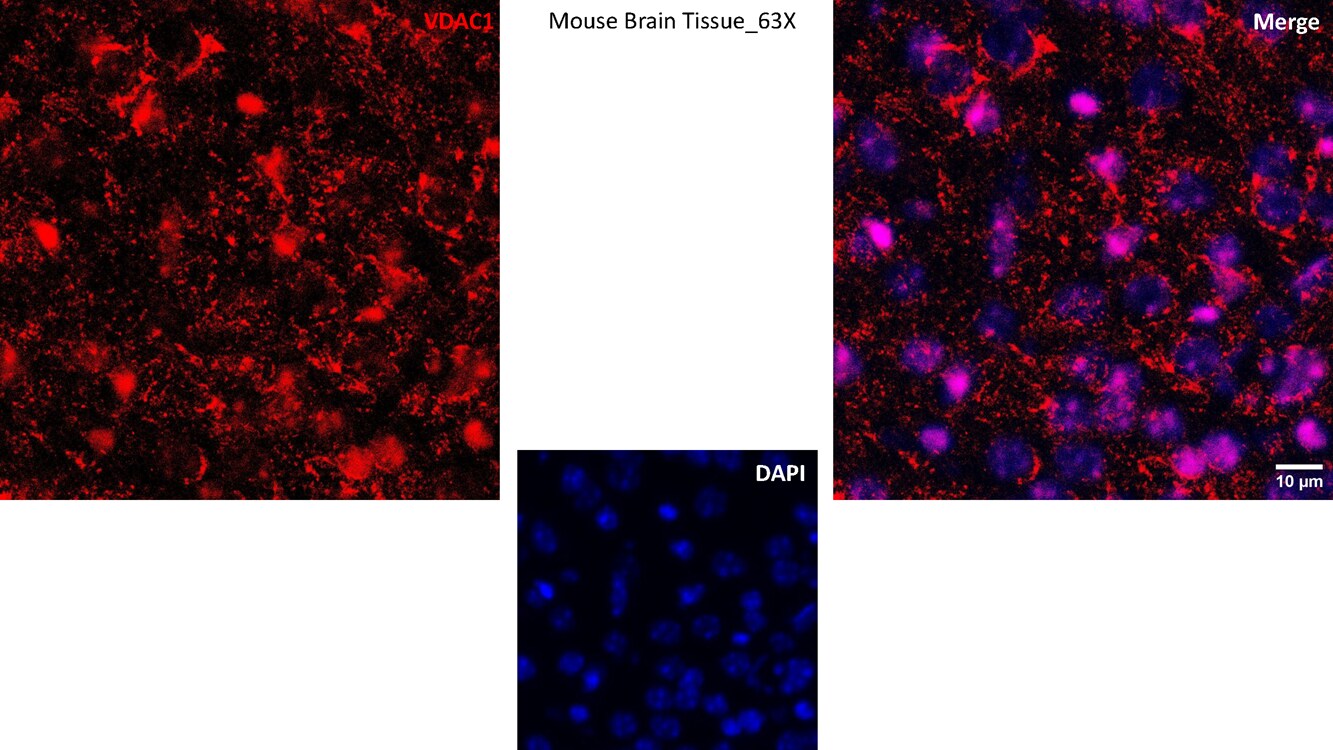 VDAC1 Antibody (6B1K1) NBP3-15871