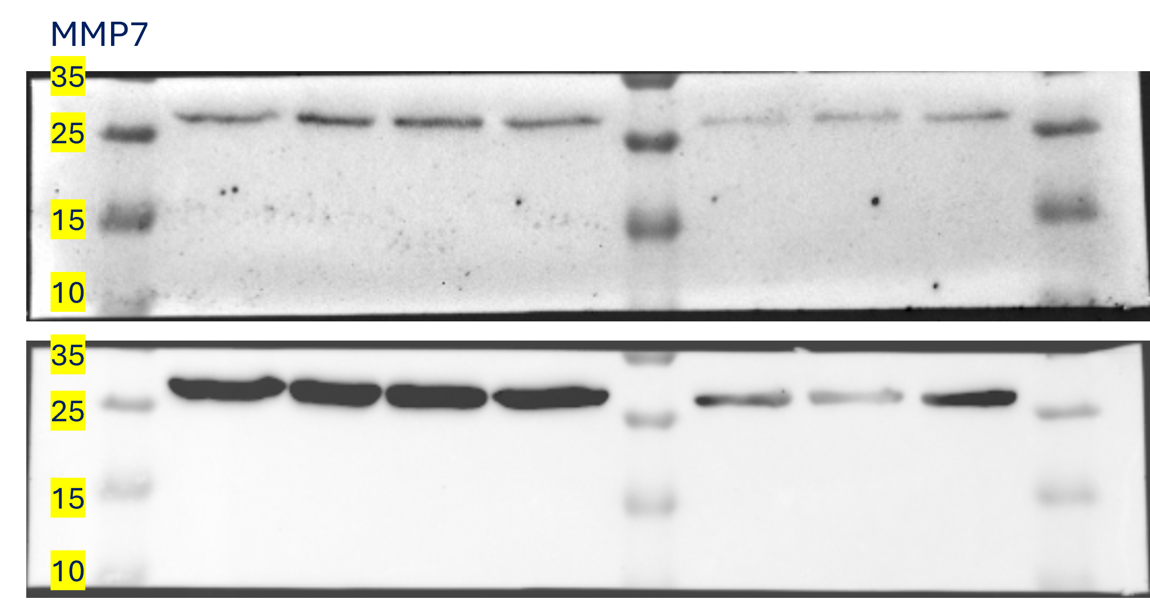 MMP-7 Antibody (8T4R8) NBP3-16067