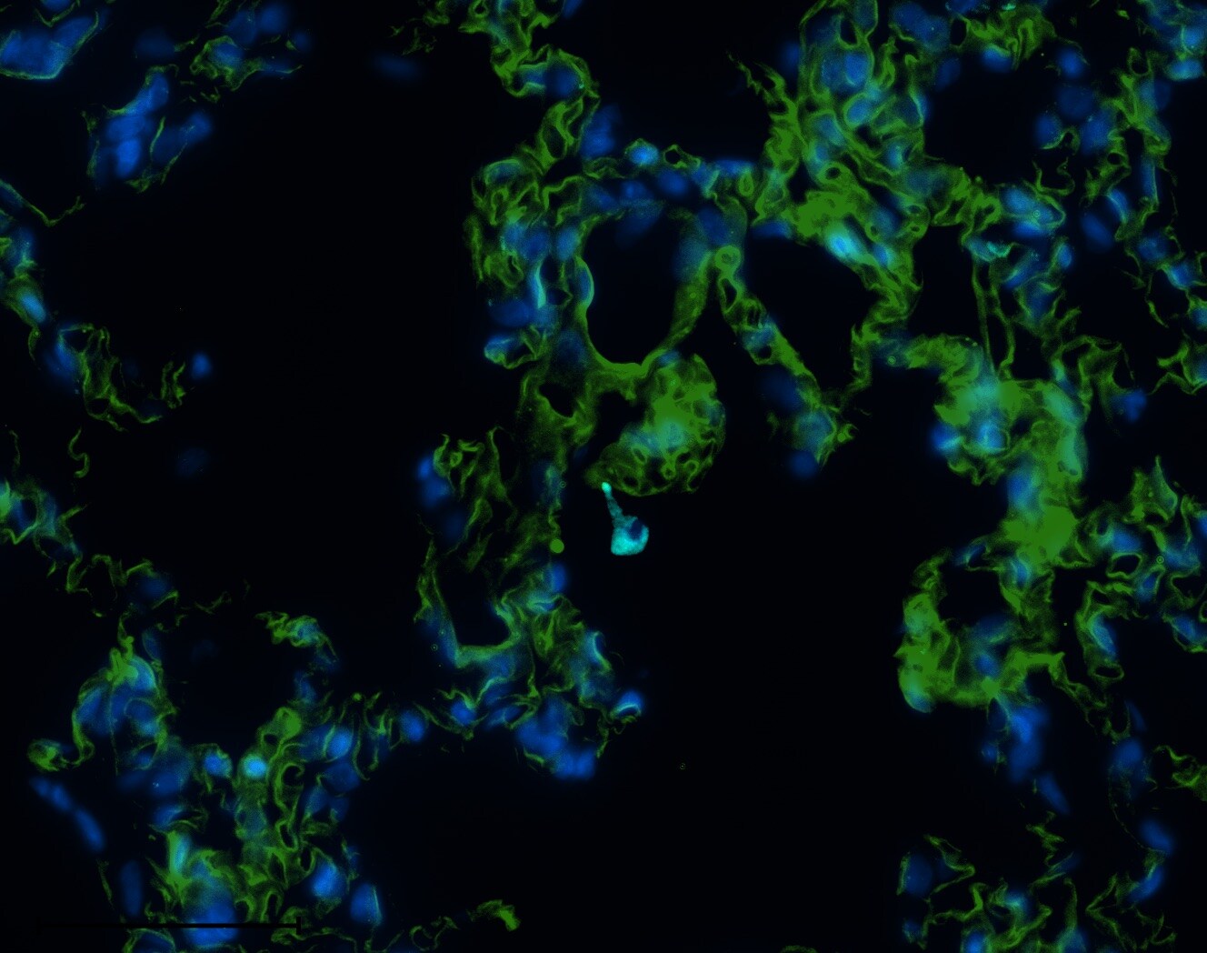 Guanylyl Cyclase beta 1 Antibody (5O8D9) NBP3-16248