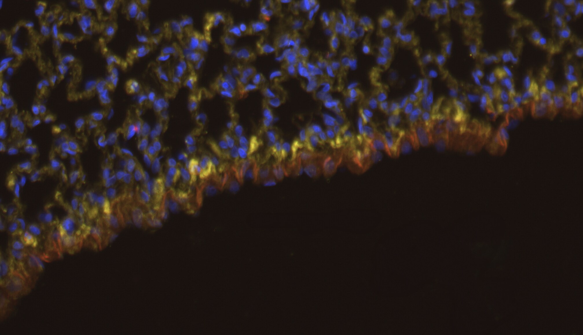 Mesothelin Antibody (MSLN/6443R) NBP3-20433