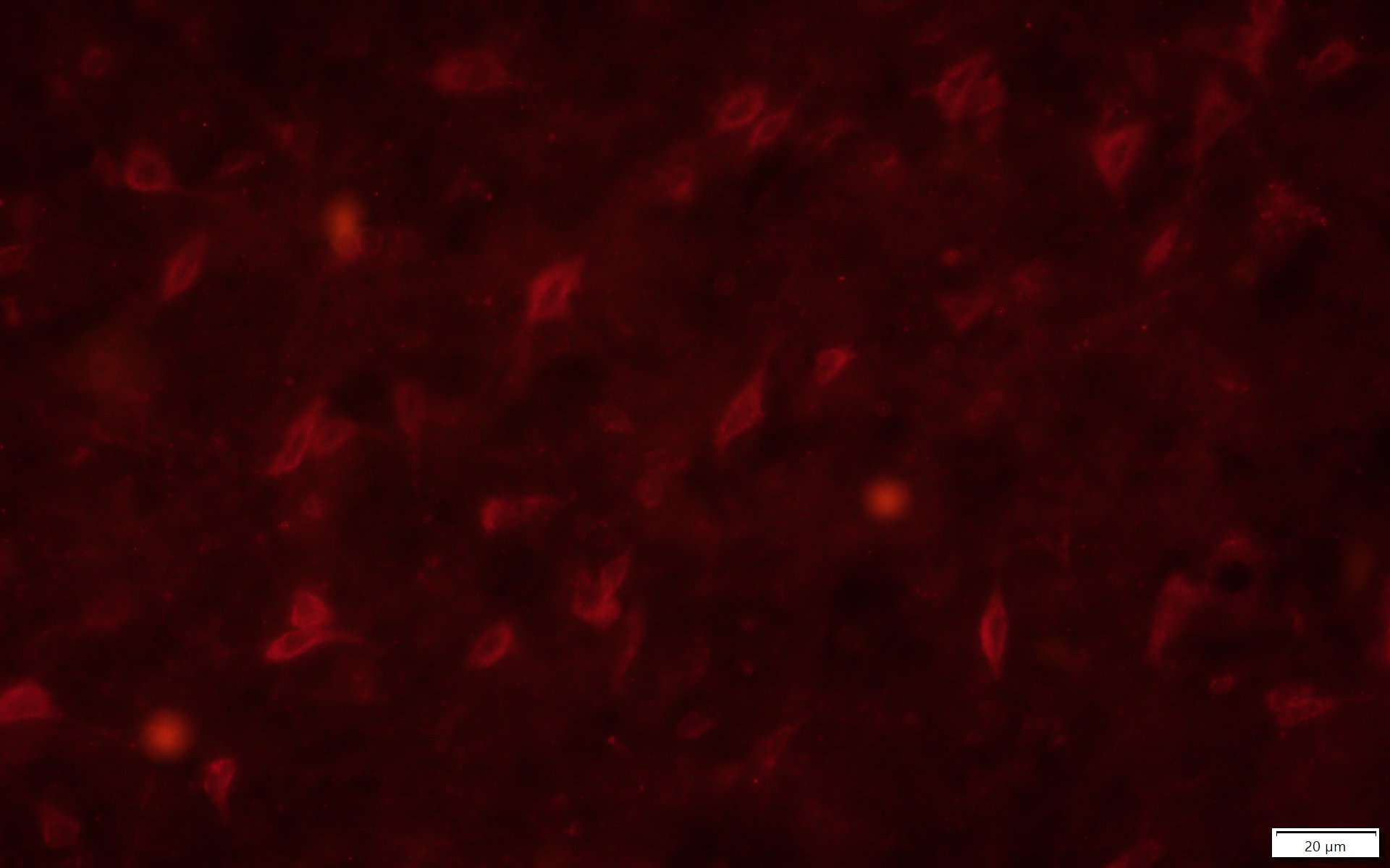 CXCR4 Antibody - BSA Free NLS1380