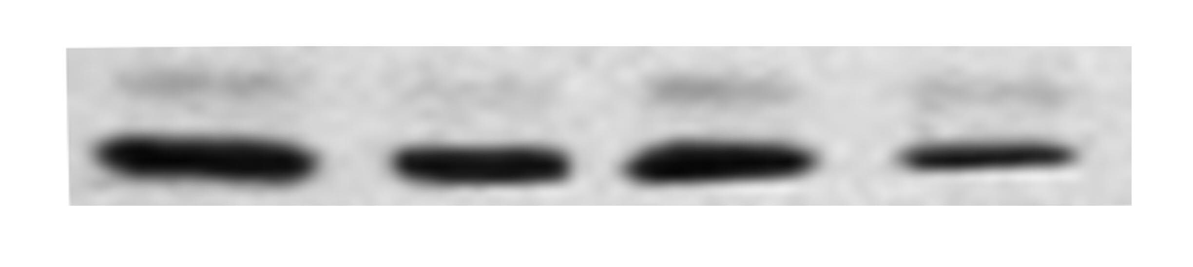 FPRL1/FPR2 Antibody - BSA Free NLS1878