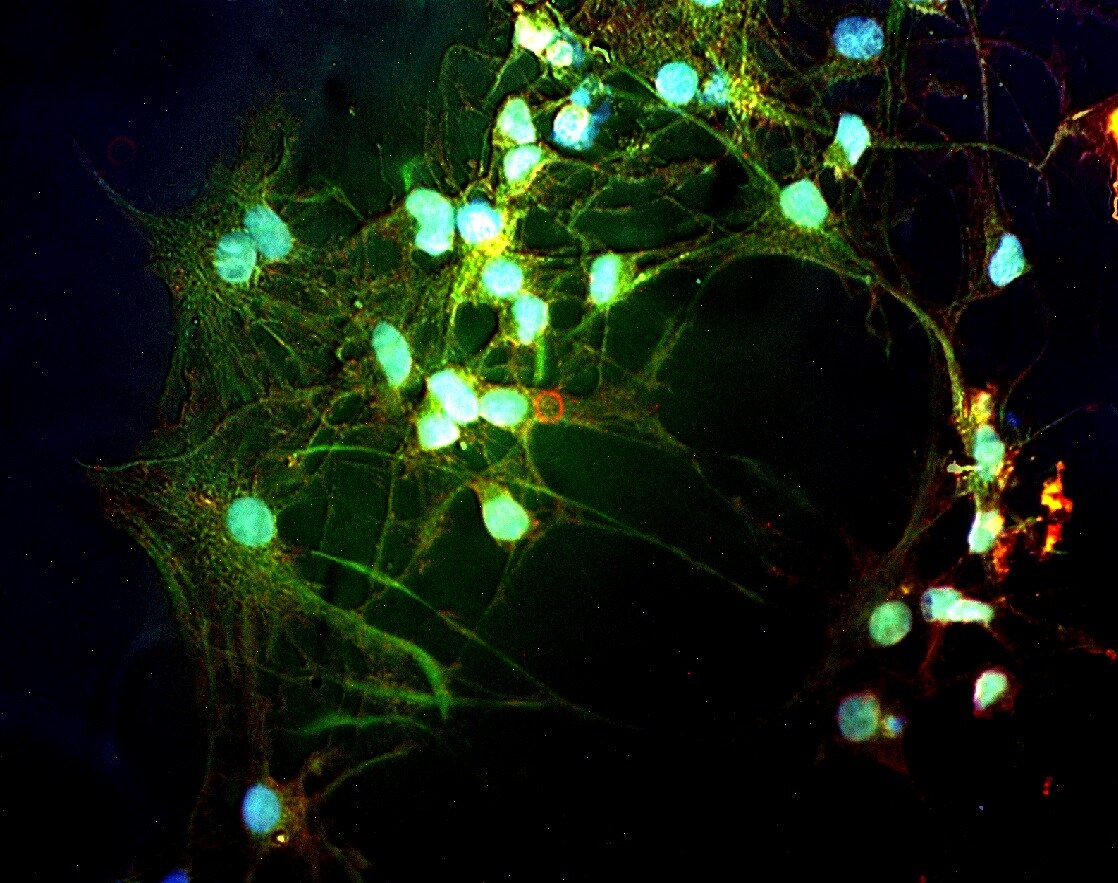 Rat Cortical Stem Cells (3 x 10e6 cells/vial) NSC001