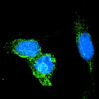 Human/Mouse GLP/EHMT1 Antibody PP-B0422-00