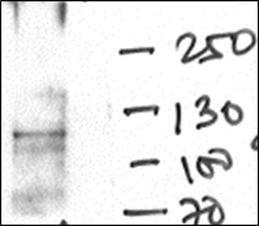 Human/Mouse GLP/EHMT1 Antibody PP-B0422-00