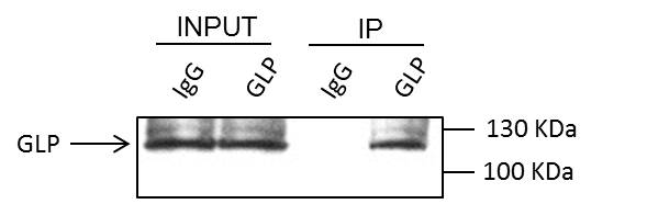 Human/Mouse GLP/EHMT1 Antibody PP-B0422-00