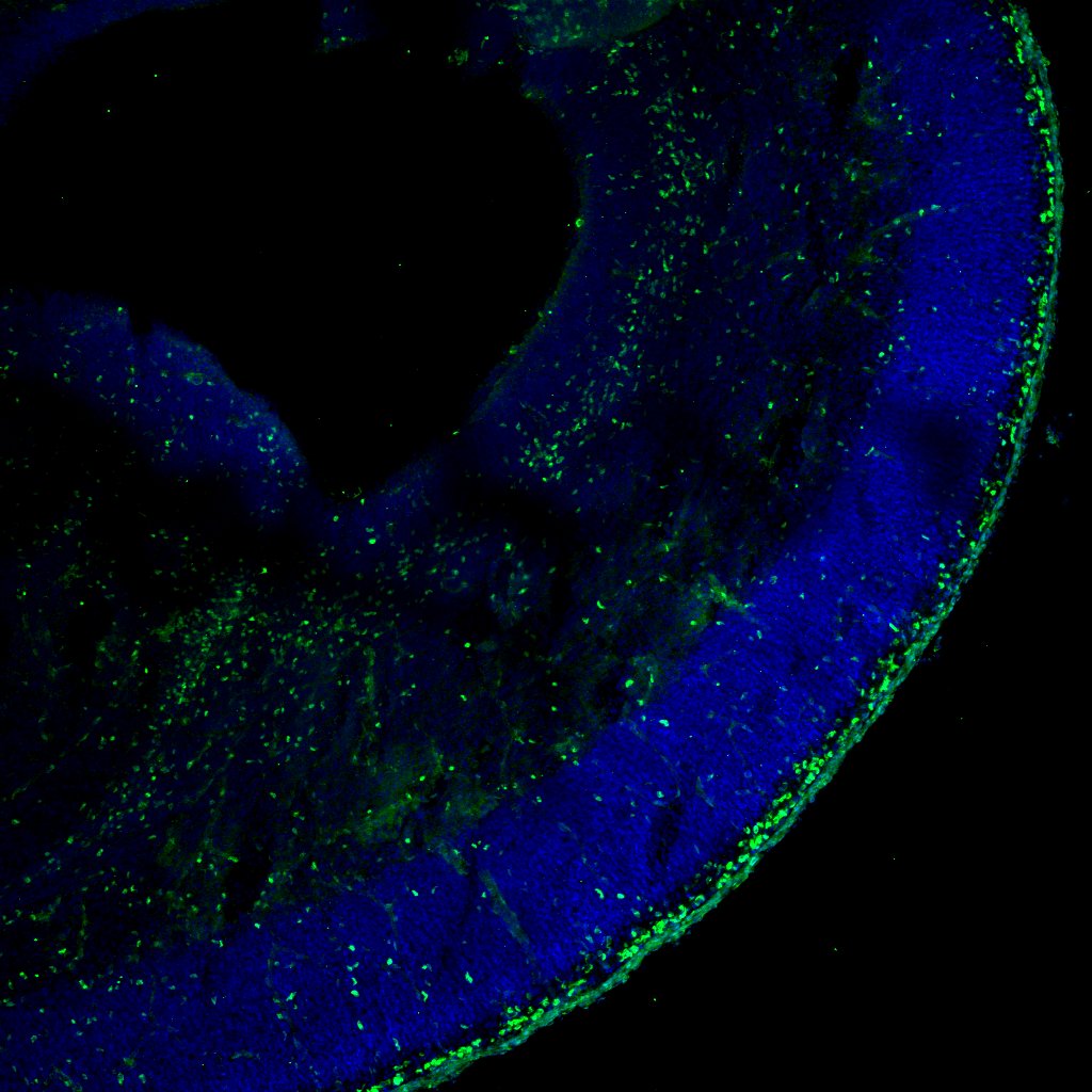 Human COUP‑TF II/NR2F2 Antibody PP-H7147-00