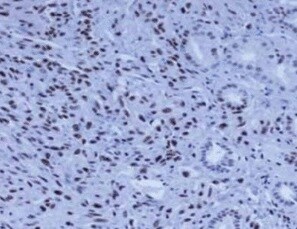 Human COUP‑TF II/NR2F2 Antibody PP-H7147-00