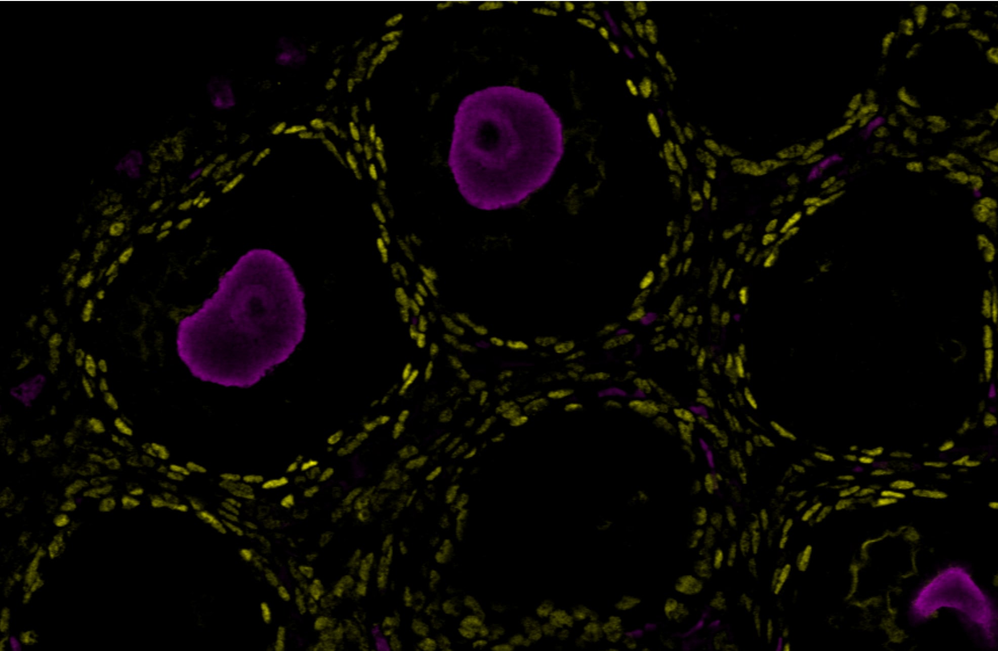 Human COUP‑TF II/NR2F2 Antibody PP-H7147-00