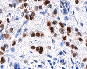 Human Androgen R/NR3C4 Antibody PP-H7507-00