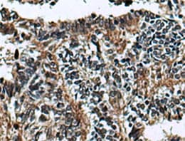Human GR Common/NR3C1 Antibody (Clone H8004) PP-H8004-00
