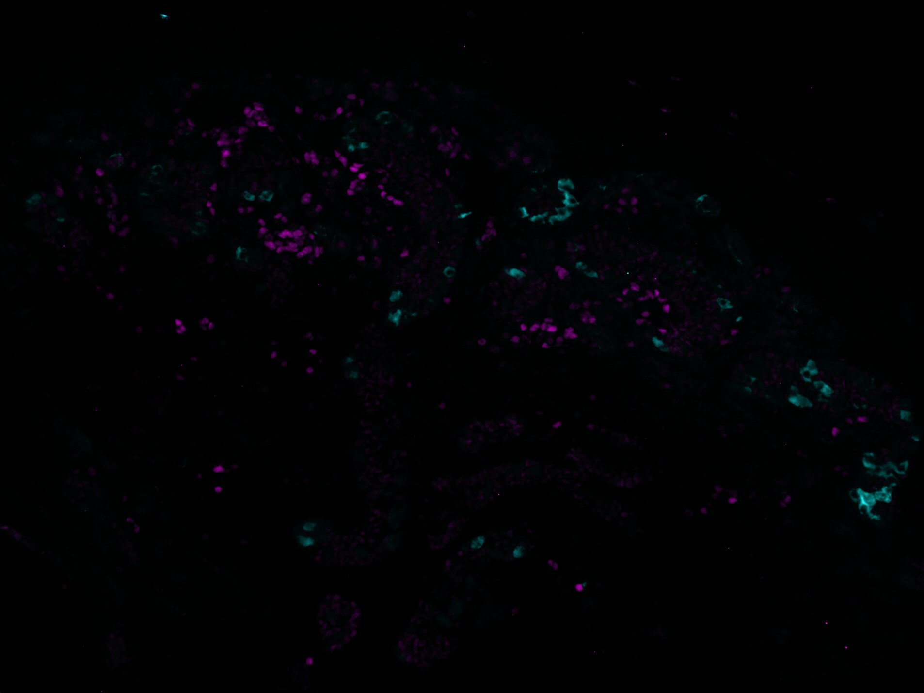 Human COUP-TF I/NR2F1 Antibody (Clone H8132) PP-H8132-00