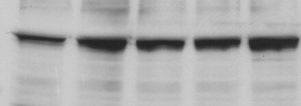 Human LXR alpha/NR1H3 Antibody (Clone K8607) PP-K8607-00
