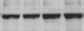Human LXR beta/NR1H2 Antibody (Clone K8917) PP-K8917-00