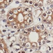 Human Nurr1/NGFI-B beta/NR4A2 MAb (Clone N1404) PP-N1404-00