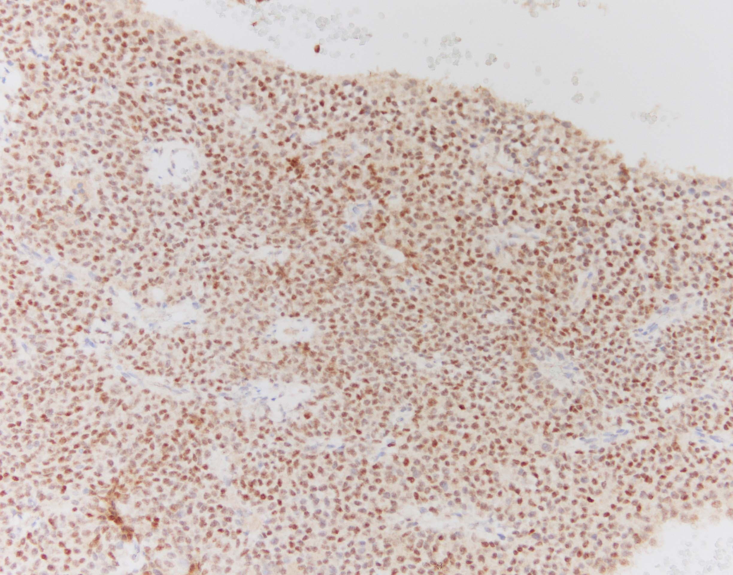 Human ER beta/NR3A2 Antibody PP-PPZ0506-00