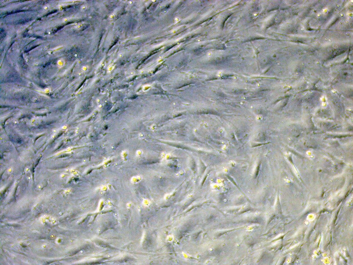 Irradiated Mouse Embryonic Fibroblasts (5 vials) PSC001