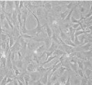 Irradiated Mouse Embryonic Fibroblasts (5 vials) PSC001