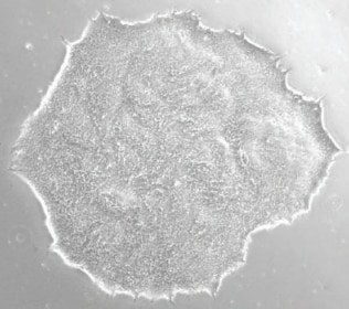 Irradiated Mouse Embryonic Fibroblasts (5 vials) PSC001
