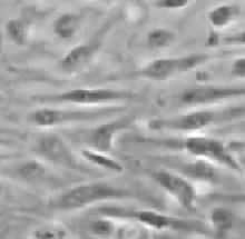 Irradiated Mouse Embryonic Fibroblasts (5 vials) PSC001