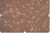 Fetal Bovine Serum - Premium S11150