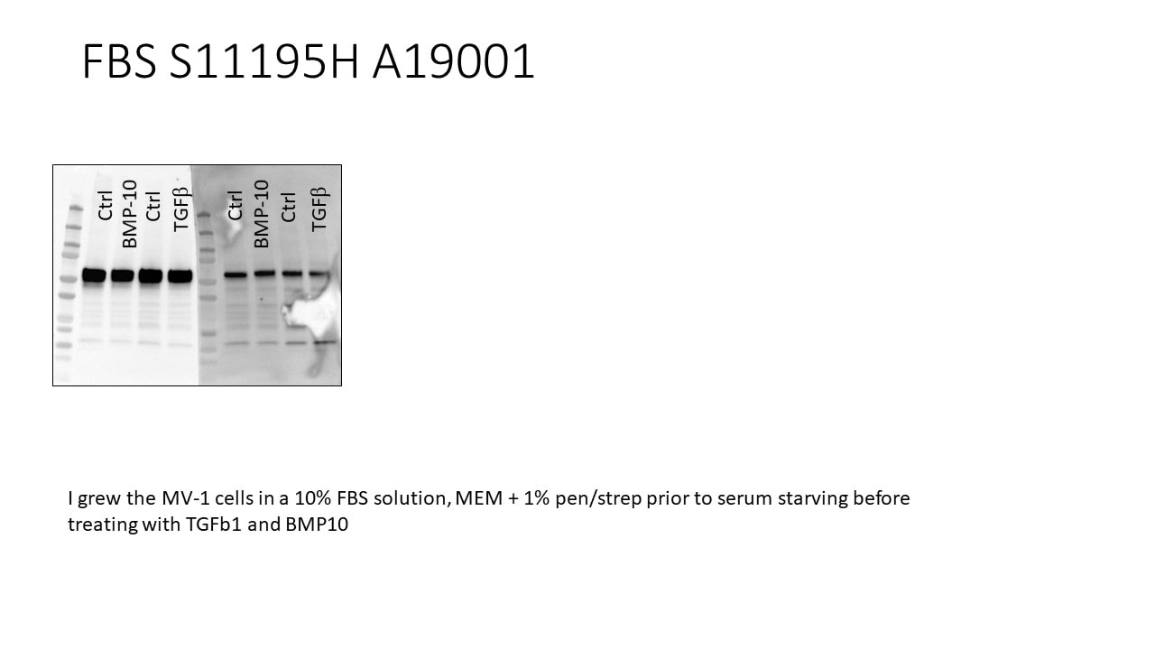 Fetal Bovine Serum - Premium, Heat Inactivated S11150H