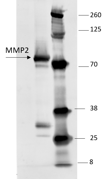 Recombinant Human MMP-2 Western Blot Standard Protein WBC025