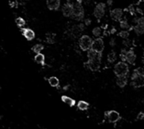 SLC38A2 Antibody - BSA Free NBP1-88872