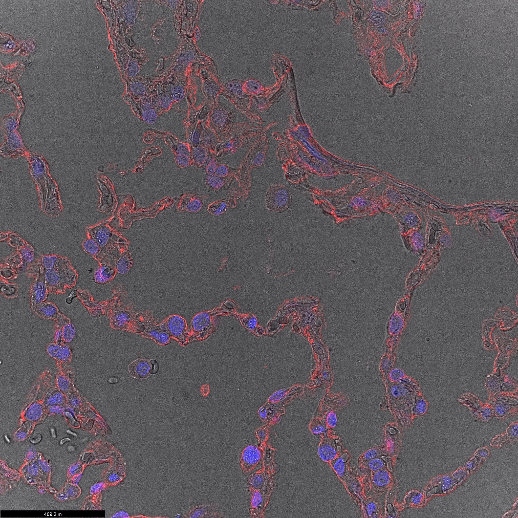 Human/Mouse/Rat RAGE/AGER Antibody AF1145